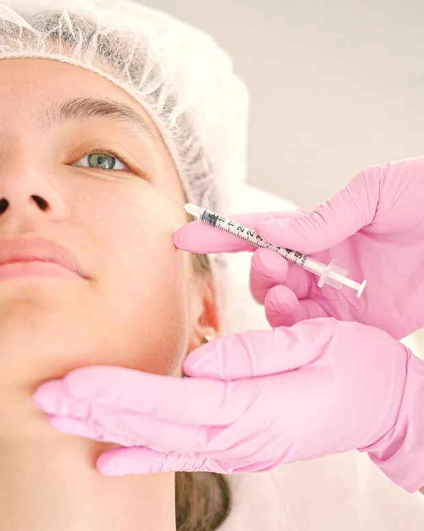 Ilustrasi Filler di Divine Aesthetic Lounge Gading Serpong