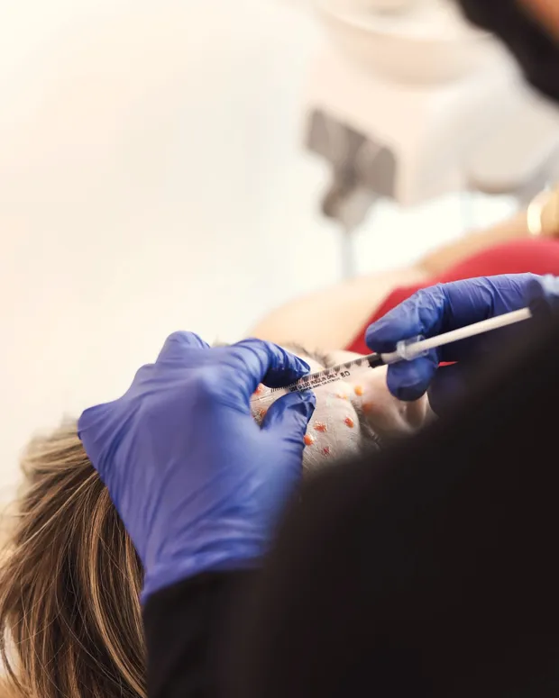 Ilustrasi Nose Threadlift di Divine Aesthetic Lounge Gading Serpong